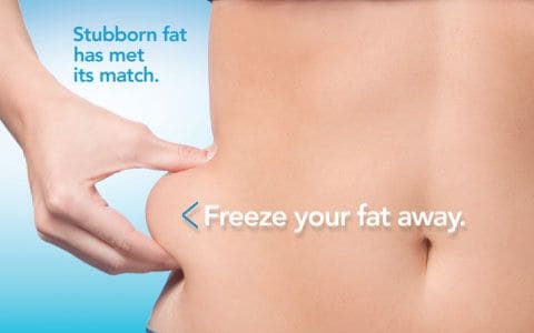 Hips treatment Impington From Lipo Sculpt