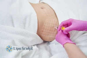 Are The Results From Aqualyx Permanent? 1 Do you want to know how long Aqualyx Impington results last?