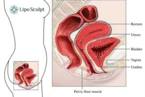 Treatment For A Leaky Bladder 2 How EM Chair treatment Impington can help Leaky bladder issues. Read more now!