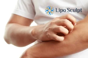 Best Actinic Keratoses Removal 4 prevent your actinic keratoses Impington getting worse - call our team today!