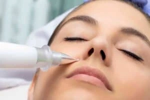 Best Actinic Keratoses Removal 3 Actinic keratoses Impington solutions - book in today!
